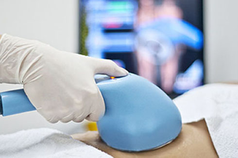 foto do aparelho manthus utilizado no tratamento da gordura localizada com ultrassom